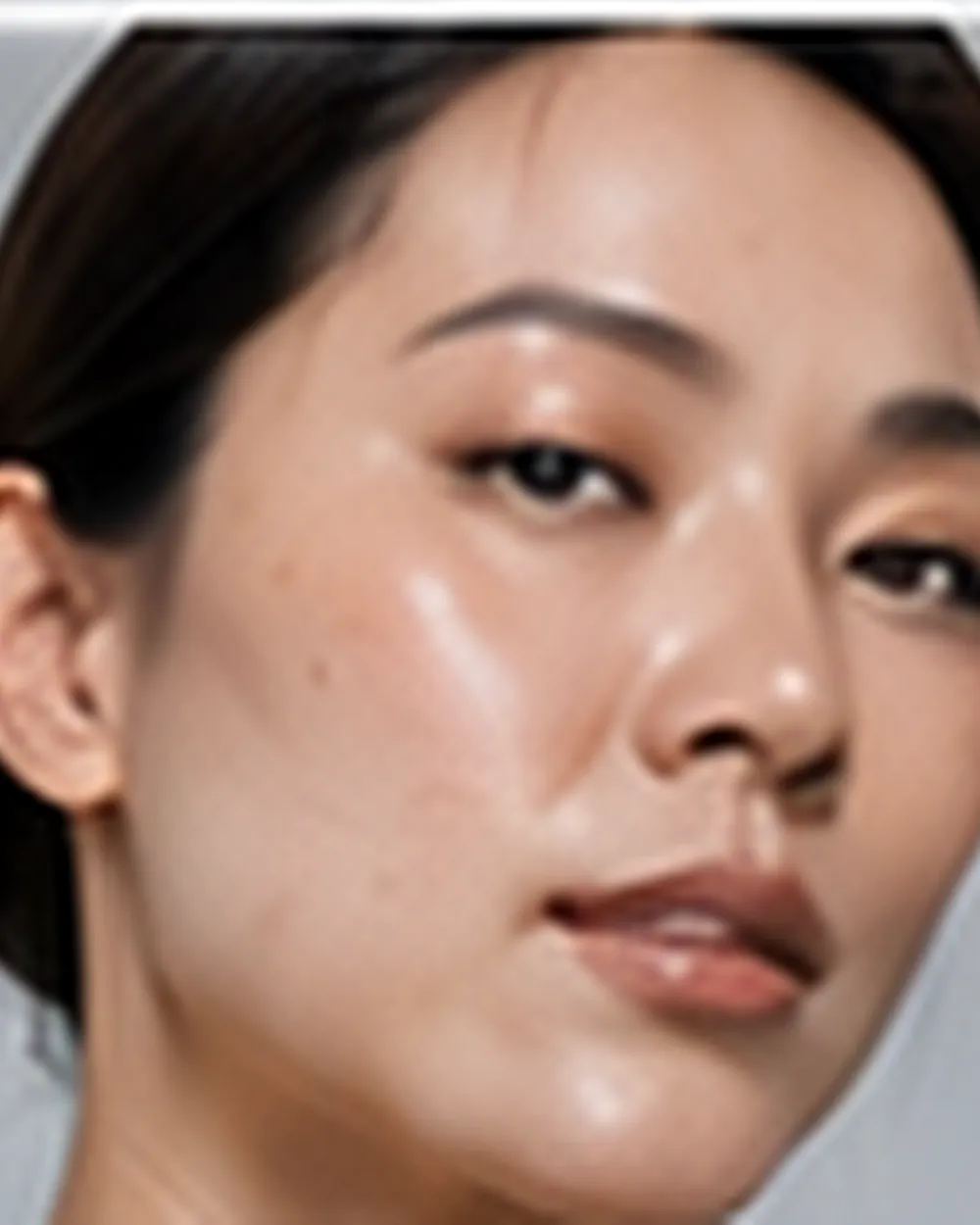 Pigmentation
