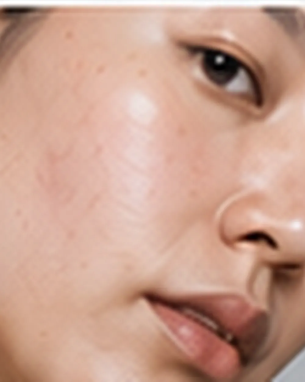 Skin Quality