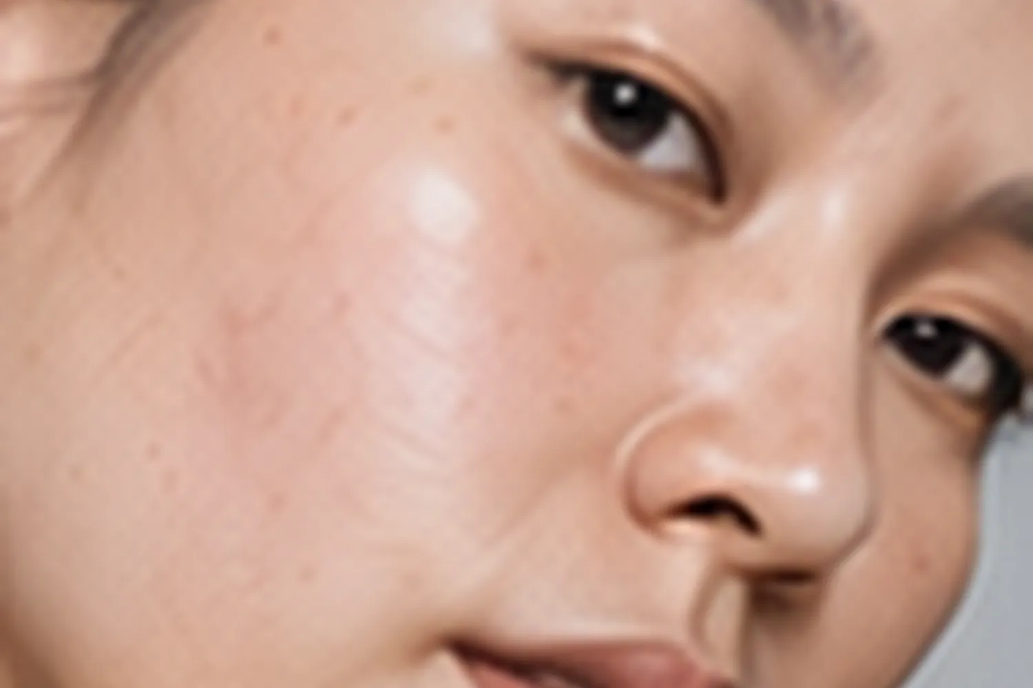 Skin Boosters - Editorial image representing this service