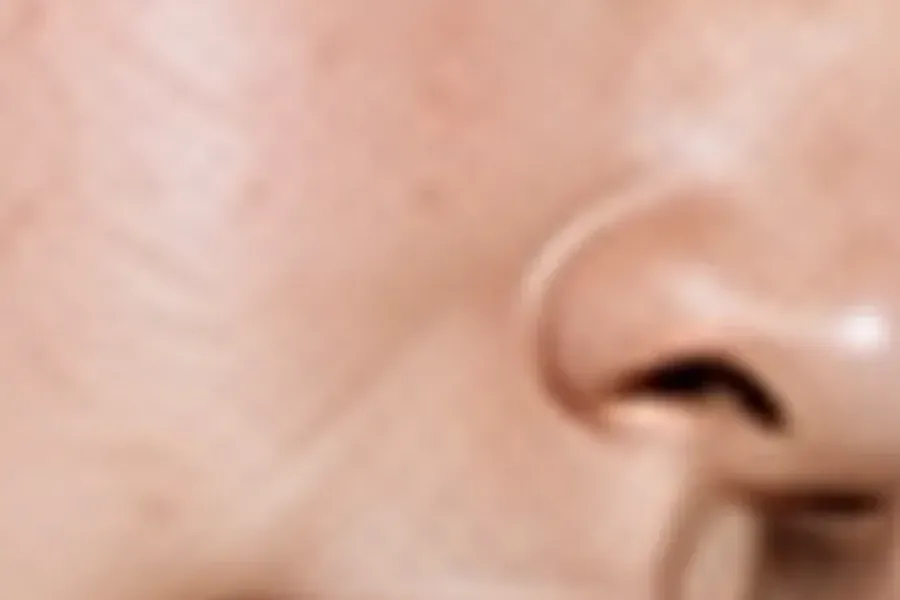 Rhinoplasty - Editorial image representing this service