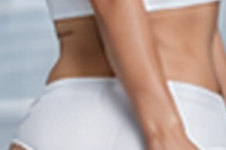 Stretch Mark Treatment - Editorial image representing this service